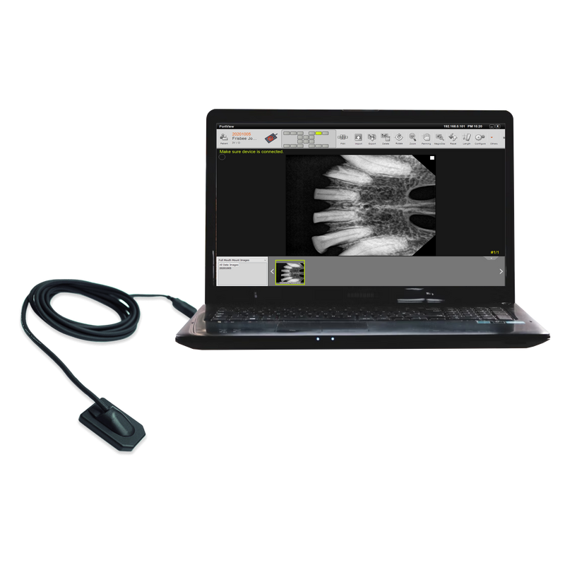 PortView - Digital Dental Intra-Oral Sensor for Zen-PX4